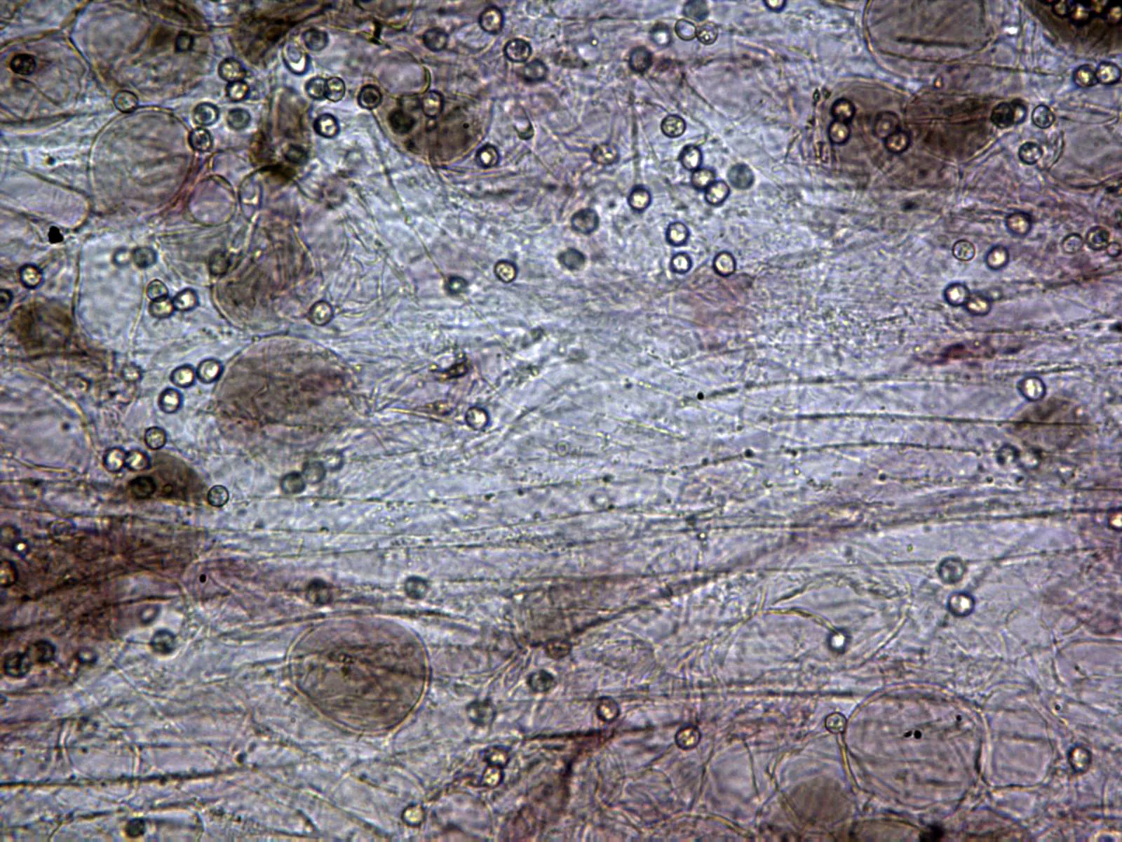 Microscopía de Pluteus satur - 10 - Subpellis x 400